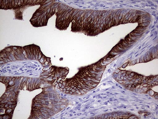 KRT20 / CK20 / Cytokeratin 20 Antibody (clone UMAB172)