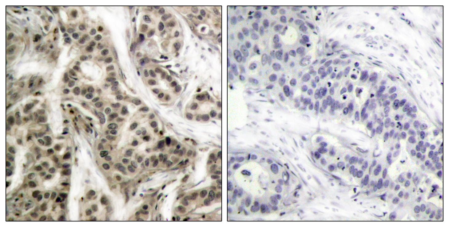 NFKB1 / NF-Kappa-B Antibody (phospho-Ser337)