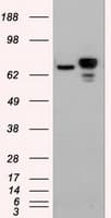 Monoclonal Mouse anti-Human CTNNB1 / Beta Catenin Antibody (clone OTI2H3, WB)