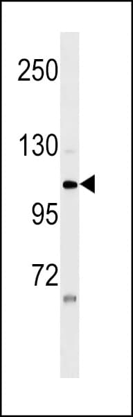 ZNF33A / KOX2 Antibody (aa73-100)