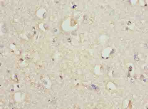 SLC30A6 Antibody