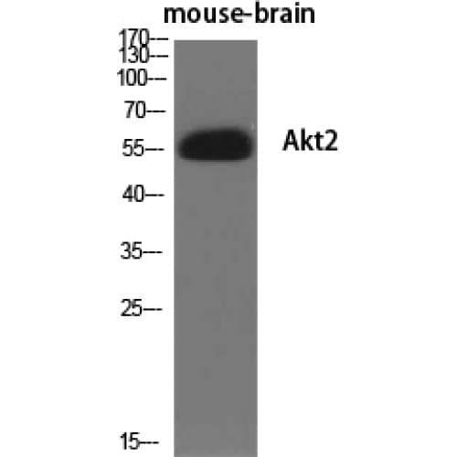 AKT2 Antibody (400-480 aa)