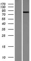 NEK5 Protein (Over-Expression Lysate Myc-DDK (Flag))