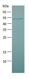 Coronavirus SARS-CoV-2 Nucleoprotein (Recombinant His)