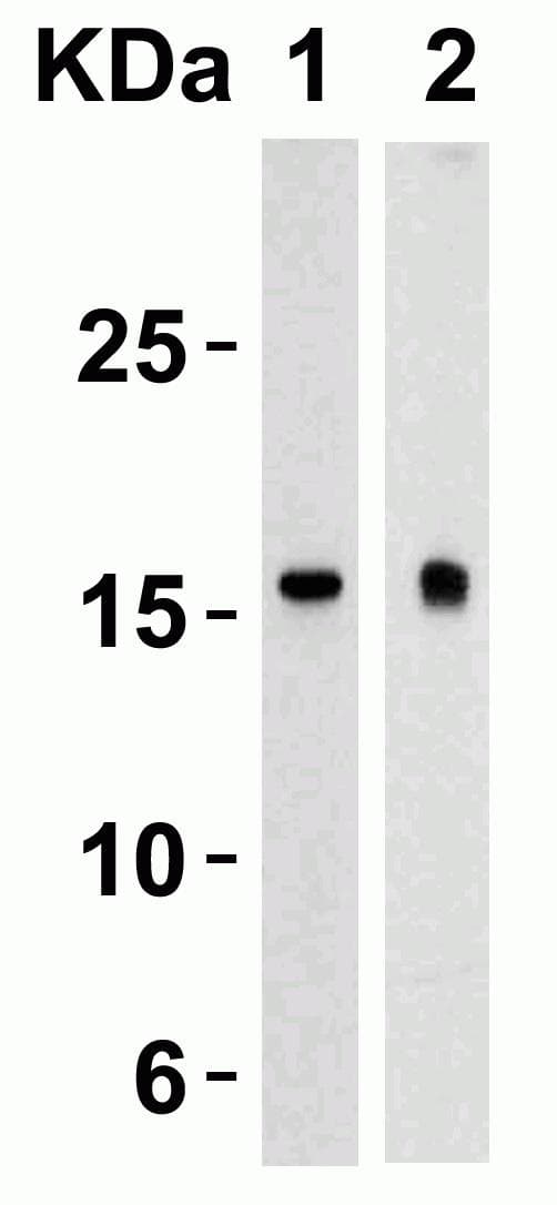 Polyclonal Rabbit anti-Human TSLP Antibody (IHC, IF, WB)