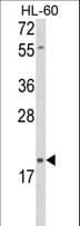 DLK2 Antibody (aa353-380)