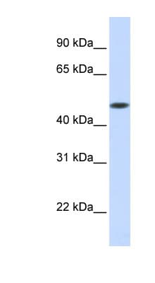 GLT8D1 Antibody (aa288-337)
