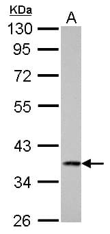 IHC-plus™ Polyclonal Rabbit anti-Human CTSS / Cathepsin S Antibody (aa32-265, IHC, WB)