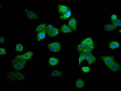 RECQL4 Antibody