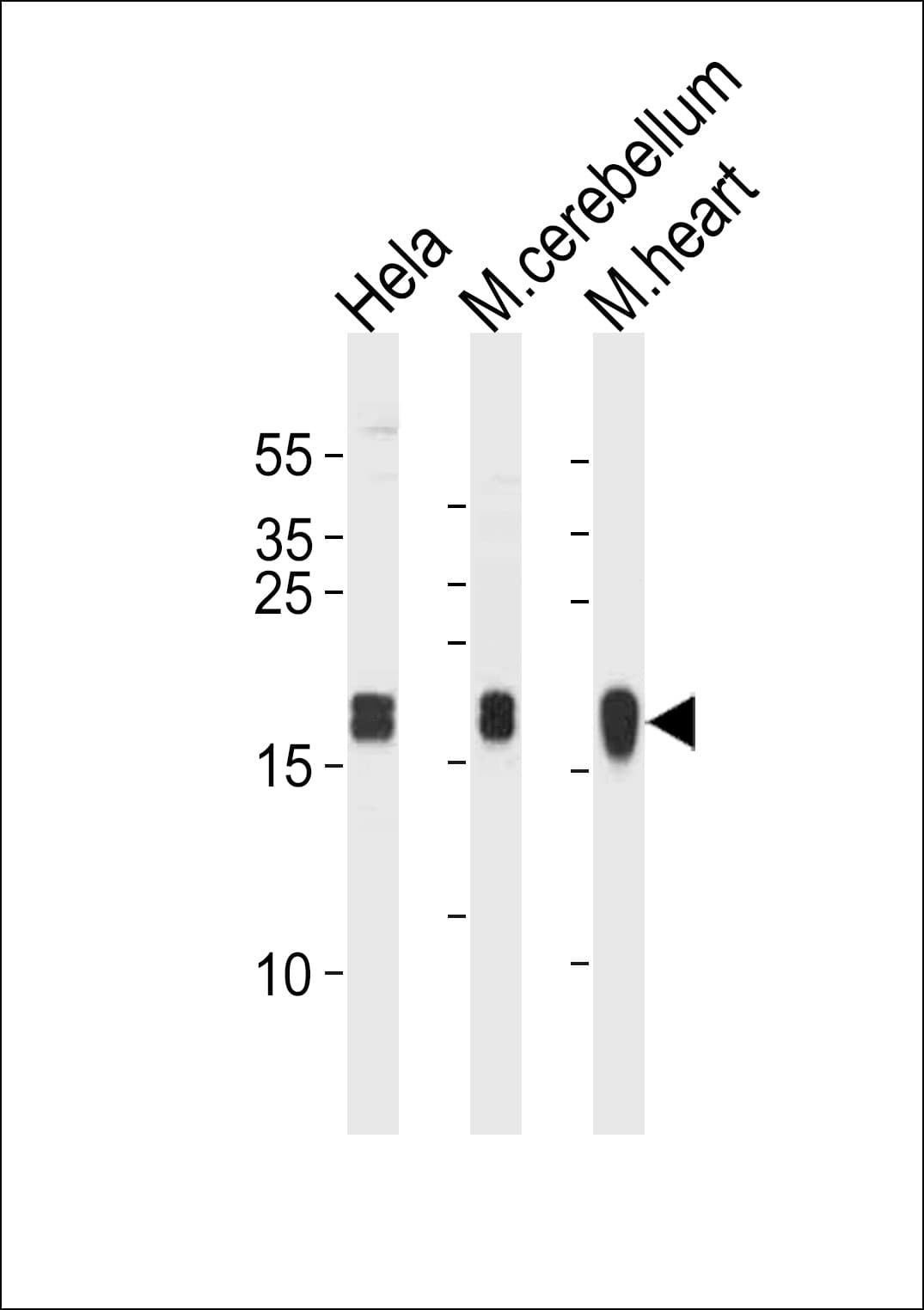 IHC-plus™ Polyclonal Rabbit anti-Human NDUFS7 Antibody (aa119-146, IHC, WB)