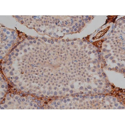 MAPT / Tau Antibody (phospho-Ser422)