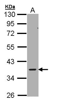 PRKAG2 / AMPK Gamma 2 Antibody (aa192-569)