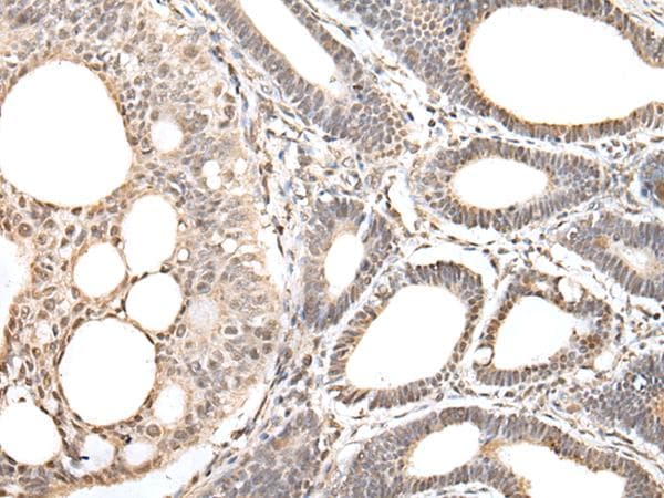 Polyclonal Rabbit anti-Human ZNF281 / Zfp281 Antibody (IHC, WB)