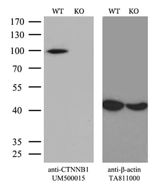 CTNNB1 / Beta Catenin Antibody (clone UMAB15)