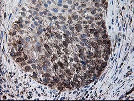 DLD / Diaphorase / E3 Antibody (clone OTI4E11)