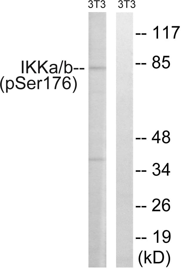 IKK Alpha+Beta Antibody (phospho-Ser176/177)