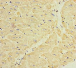 Polyclonal Rabbit anti-Human Dermatopontin / DPT Antibody (IHC)