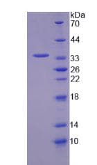 Rat TKT / Transketolase Protein (Recombinant His-S)