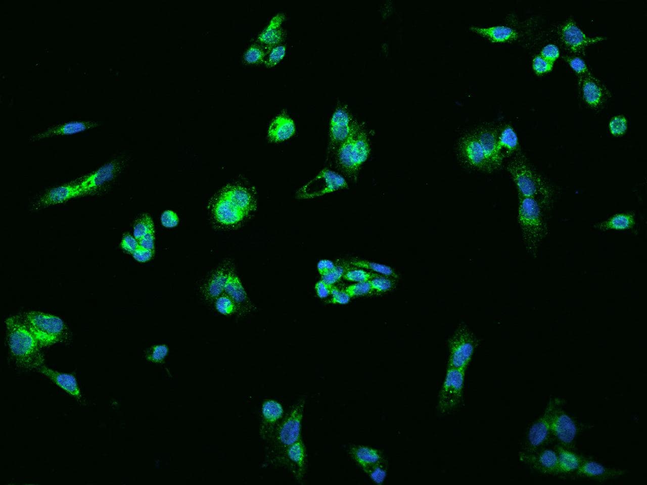 Antithrombin-III Antibody