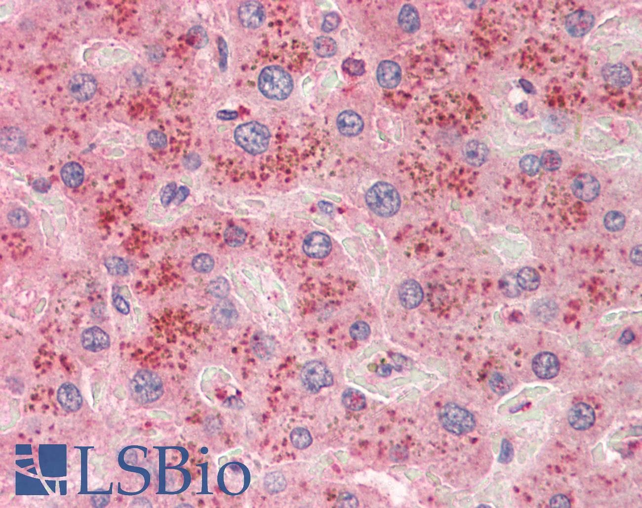 IHC-plus™ Polyclonal Goat anti-Human SLC6A12 / BGT-1 Antibody (aa587-601, IHC, WB)
