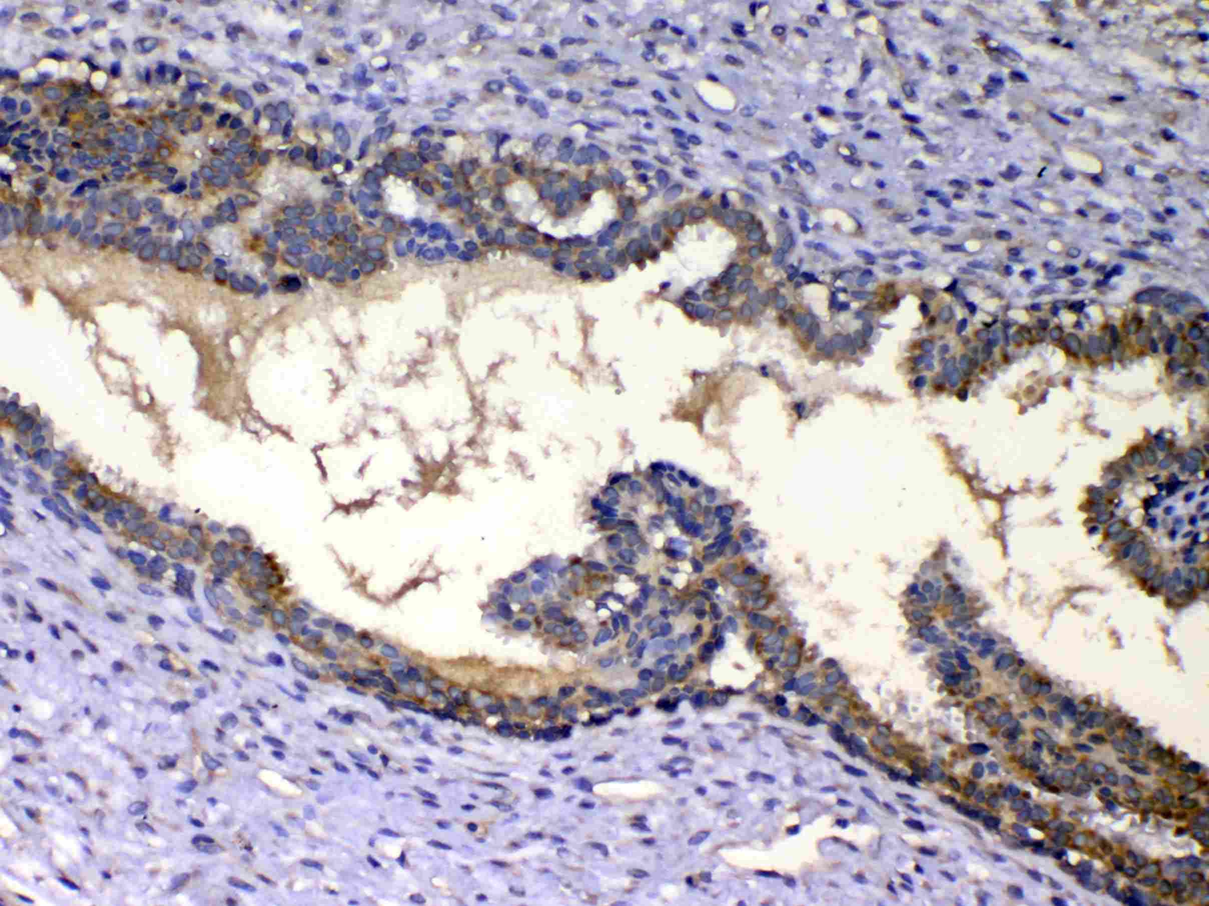 IGFBP2 / IGF-BP53 Antibody