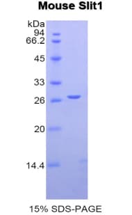 Mouse SLIT1 Protein (Recombinant His)