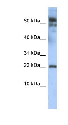 LDOC1 Antibody (N-Terminus)