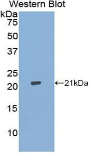 ACO1 / Aconitase Antibody (aa26-189)