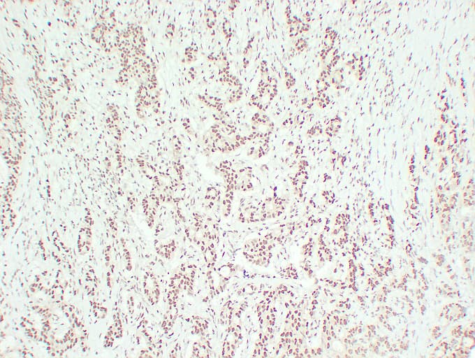ER Alpha / Estrogen Receptor Antibody (clone ABT-ER)