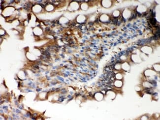 PRDX5 / Peroxiredoxin 5 Antibody