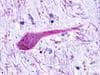 PathPlus™ Polyclonal Rabbit anti-Human RAIG2 / GPRC5B Antibody (C-Terminus, IHC)