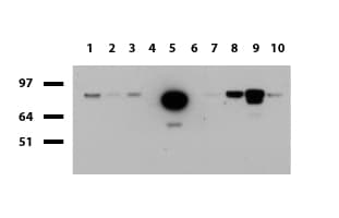 FOLH1 / PSMA Antibody (clone UMAB25, Carrier-free)