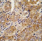 Polyclonal Rabbit anti-Human TRPM8 Antibody (aa926-956, IHC, WB)