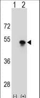 SNAPC1 Antibody (aa139-168)