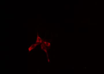 CAMK2A / CaMKII Alpha Antibody