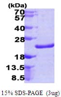 Human NUDT10 Protein (Recombinant His)