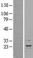 Human IFN Beta / Interferon Beta Protein (Over-Expression Lysate Myc-DDK (Flag))