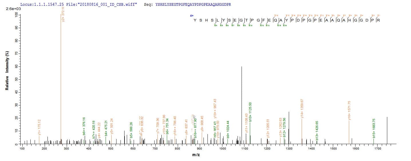 Human LOXL1 Protein (Recombinant)