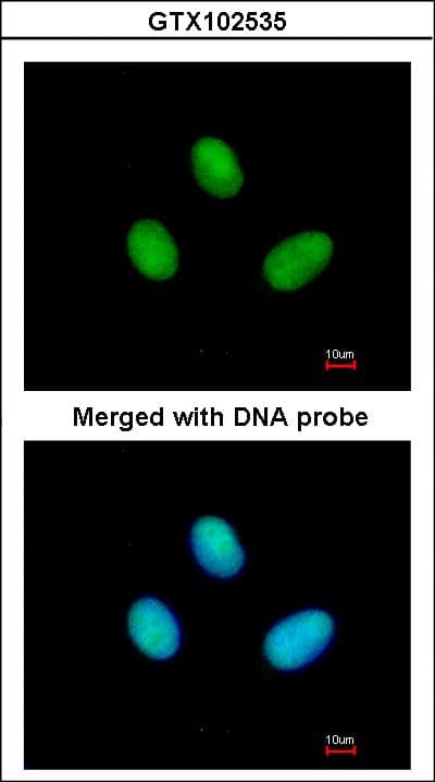 Polyclonal Rabbit anti-Human POLR2B / RPB2 Antibody (aa1-172, IHC, WB)