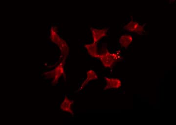 TNFRSF17 / BCMA Antibody