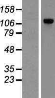 POP1 Protein (Over-Expression Lysate Myc-DDK (Flag))