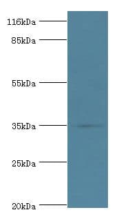DIMT1L Antibody (aa1-313, Biotin)