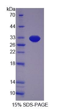 Human DATF1 / DIDO1 Protein (Recombinant His-S)