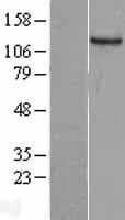 GUCY2C / Guanylyl Cyclase C Protein (Over-Expression Lysate Myc-DDK (Flag))