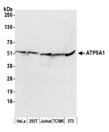 Polyclonal Rabbit anti-Human ATP5A1 / ATP Synthase Alpha Antibody (aa175-225, IHC, WB)