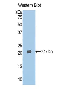 ANXA4 / Annexin IV Antibody (aa153-307)