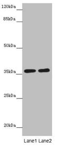 GNB1L / FKSG1 Antibody