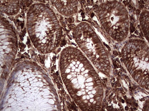 PKM2 Antibody (clone OTI12D5, Carrier-free)