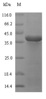 Mycoplasma pneumoniae Oligoendopeptidase F homolog Protein (Recombinant 6His-SUMO, N-terminus)