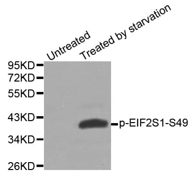EIF2S1 Antibody (phospho-Ser49)